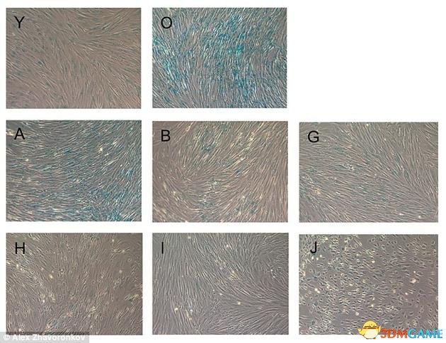 细胞培养结束之后，研究人员再次测量了包括细胞大小、形状和内部结构复杂性等特征，同时还有一种与衰老有关的标记物——β-半乳糖苷酶的浓度。上图为成纤维细胞的β-半乳糖苷酶染色结果，蓝色代表细胞的衰老。