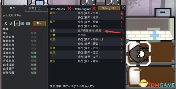 环世界 a17丧尸启示录mod