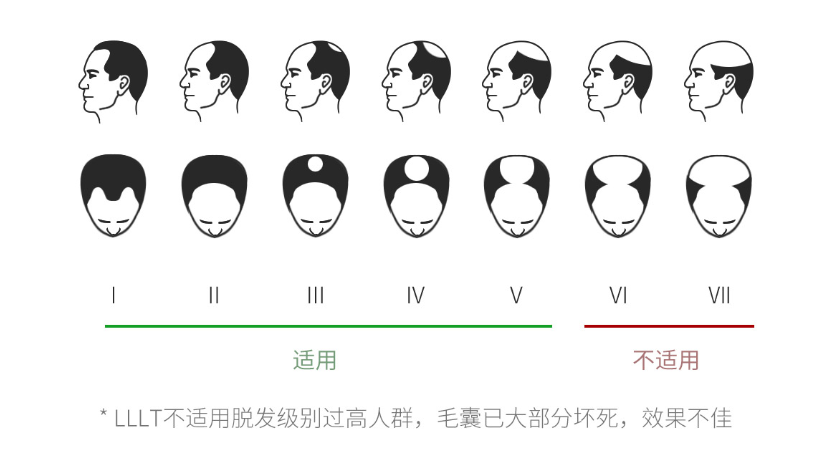 小米有品众筹LLLT激光生发帽：仅12周长出新发