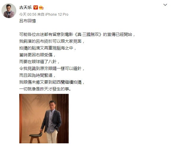 古天乐爆料：拍《真三国无双》右眼球曾受伤缝八针