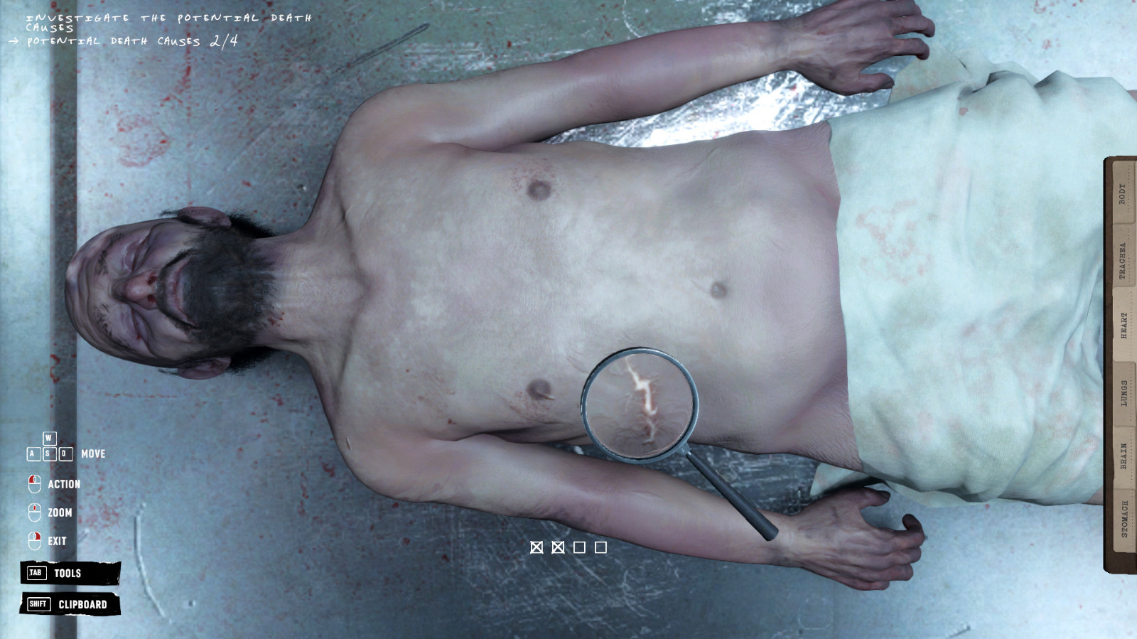 《验尸模拟器》试玩Demo现已上线 支持简繁体中文